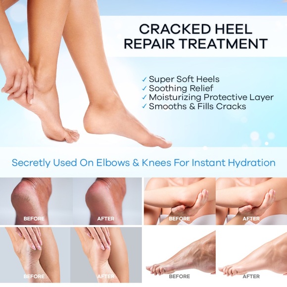 2 PCS Anti-Cracking Repair Cream stick - Picture 3 of 8